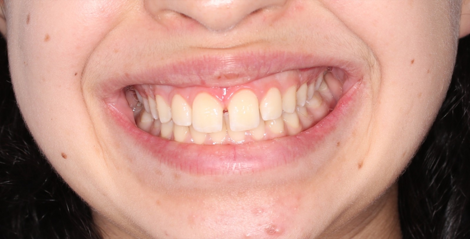 A close-up of a bright, even smile